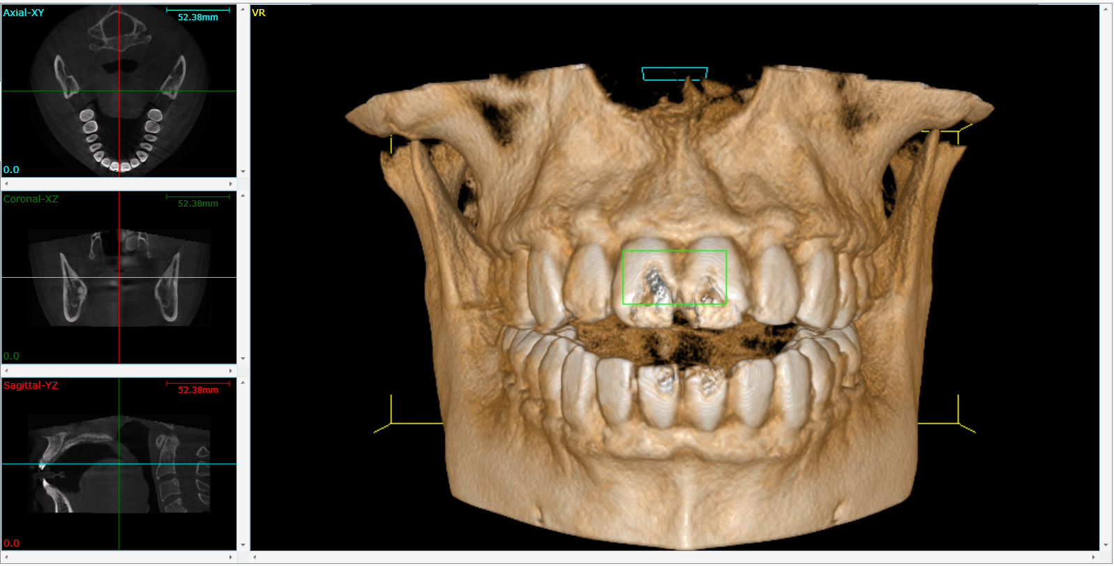 Cone Beam 3D Imaging  Cerritos, CA 