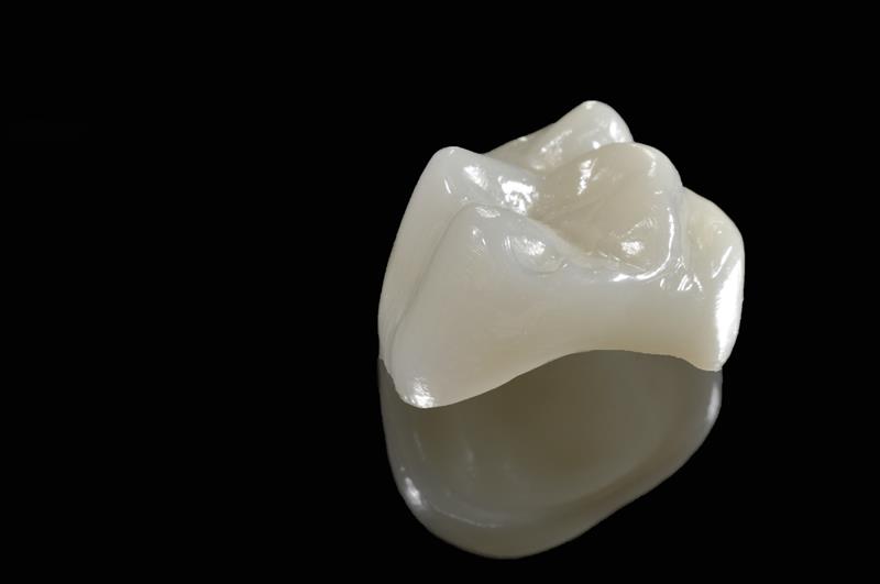 Porcelain Crowns  Cerritos, CA 